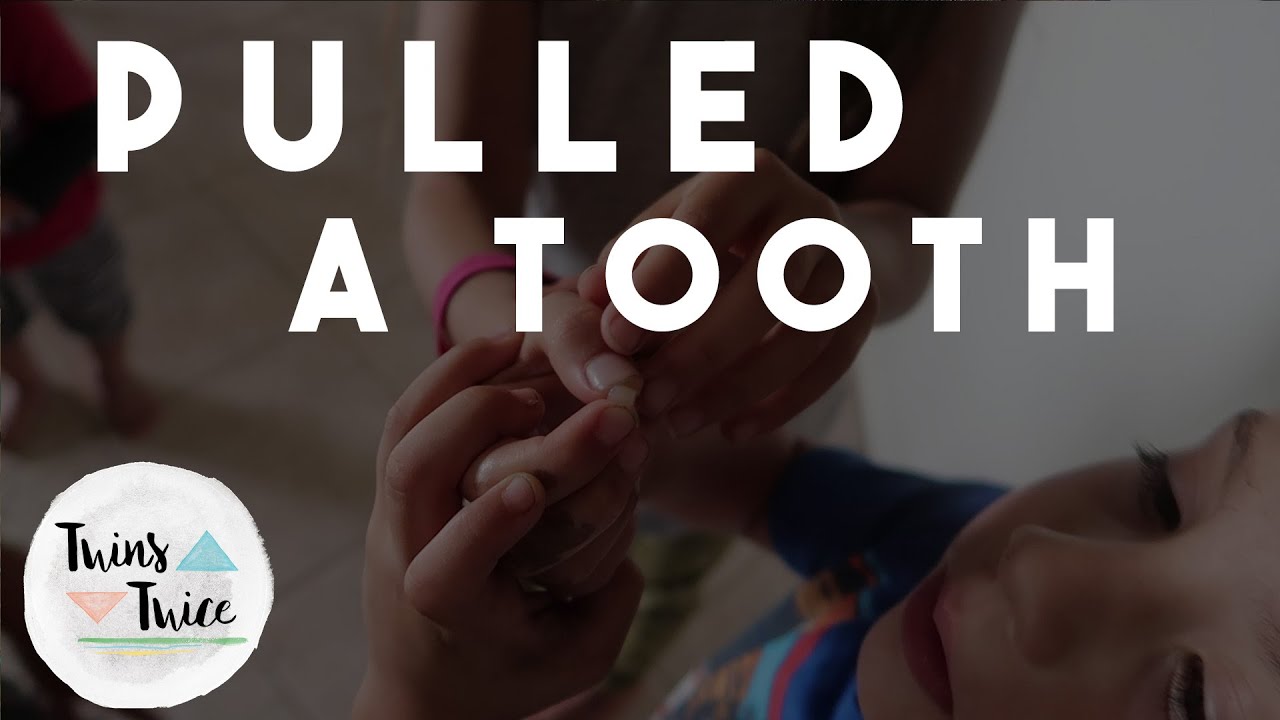 PULLED A TOOTH! (6-11-16 – Day 201)